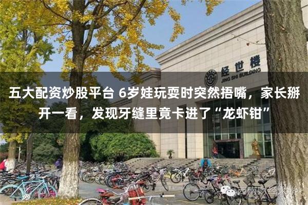 五大配资炒股平台 6岁娃玩耍时突然捂嘴,家长掰开一看,发现牙缝里竟卡进了“龙虾钳”